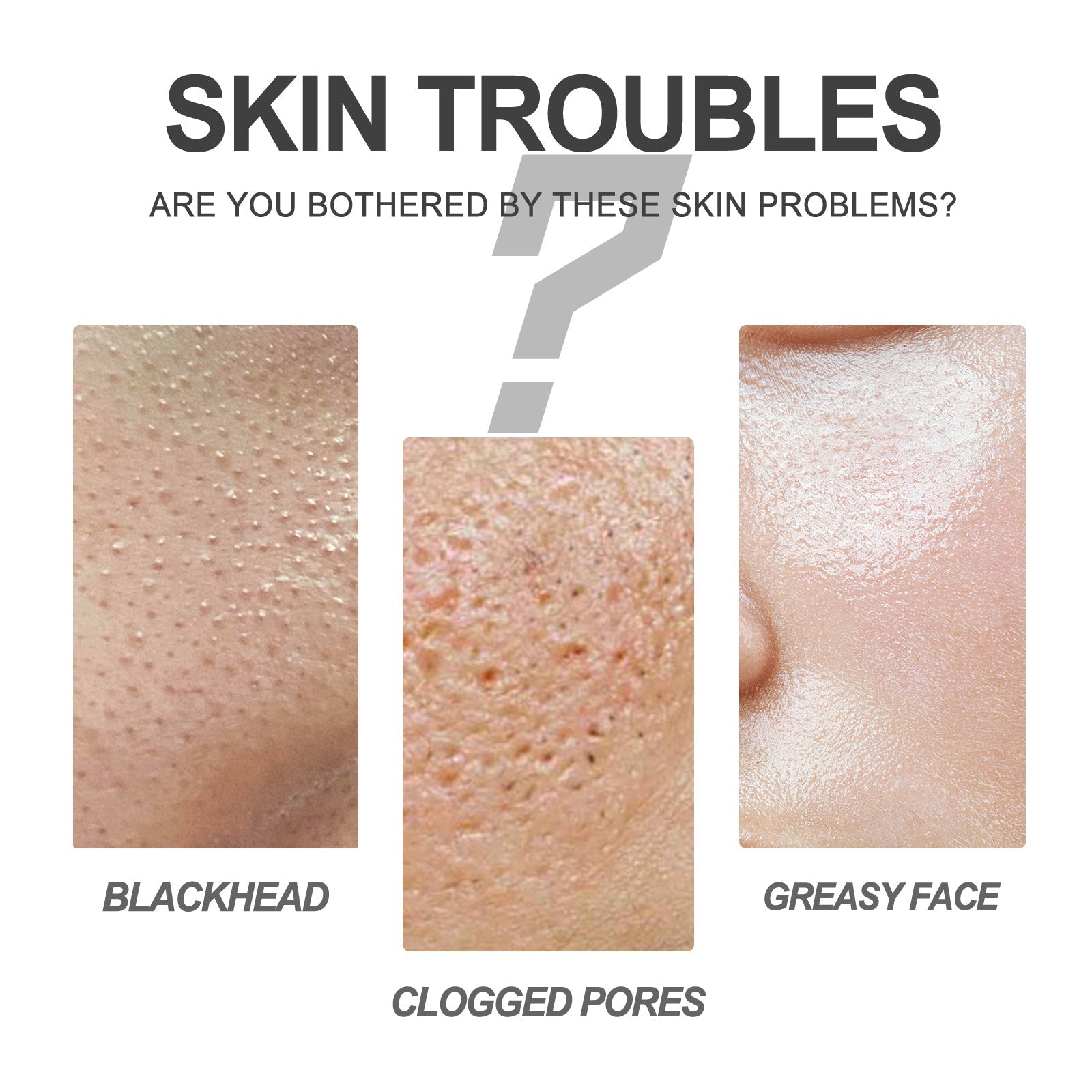 EELHOE Blackhead Cleansing Cream Skin Oil